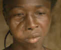 Maimed Girl